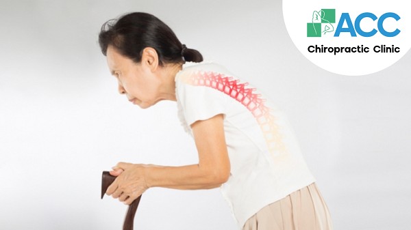 Hình ảnh biến dạng cột sống